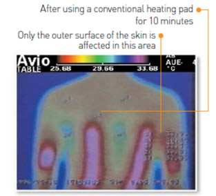 Before Thermotherapy